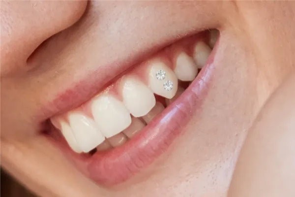 gema dental gema dental