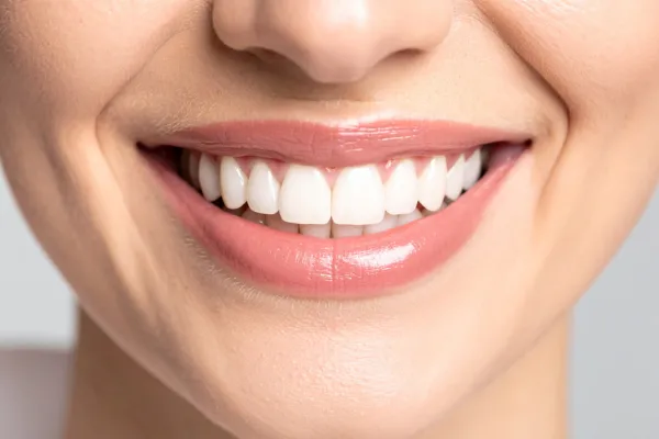Estética dental Estética dental