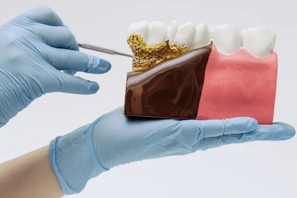 Periodoncia Periodoncia
