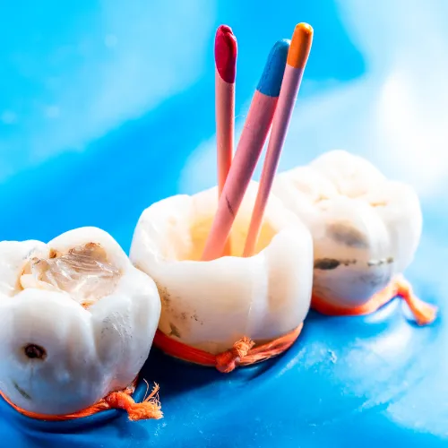 endodonciaHome endodonciaHome