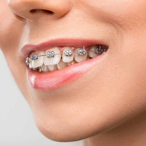 ortodonciaHome ortodonciaHome